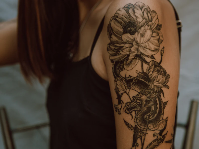 Tattoo Laten Verwijderen screenshot 2